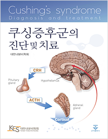 쿠싱증후군의 진단 및 치료